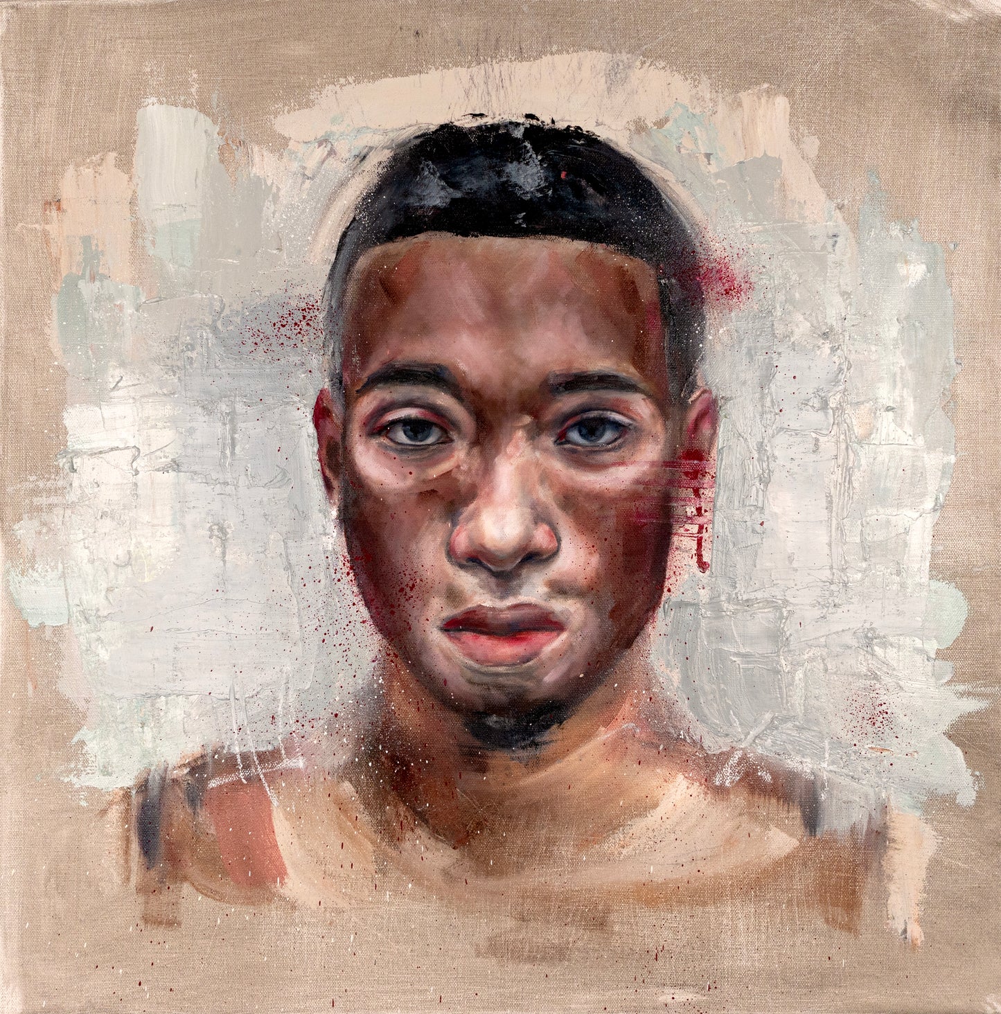 Vitiligo is Beautiful | Original Oil Painting